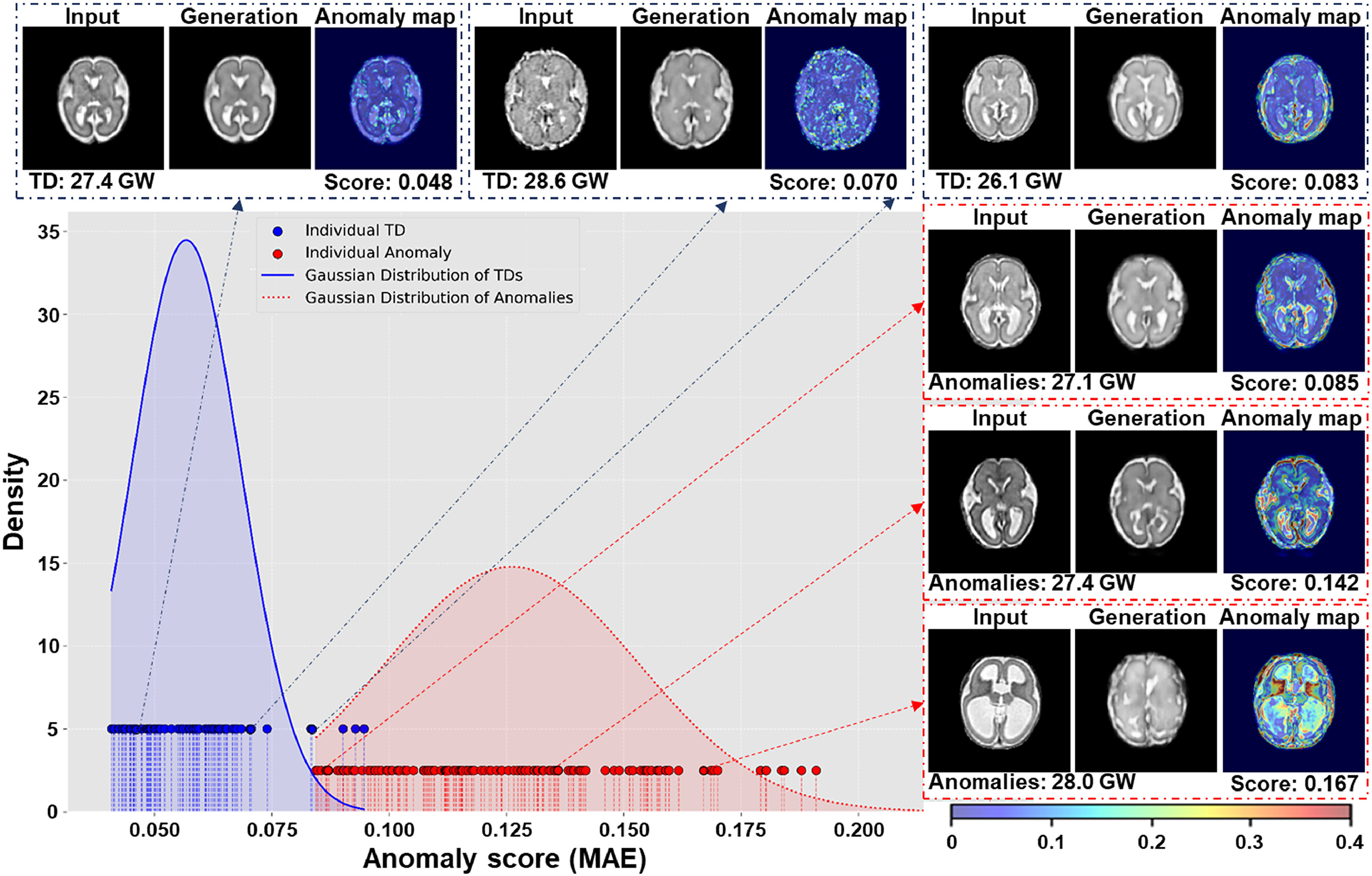 Anomaly detection results on fetal brain MRI from NeuroImage 2025