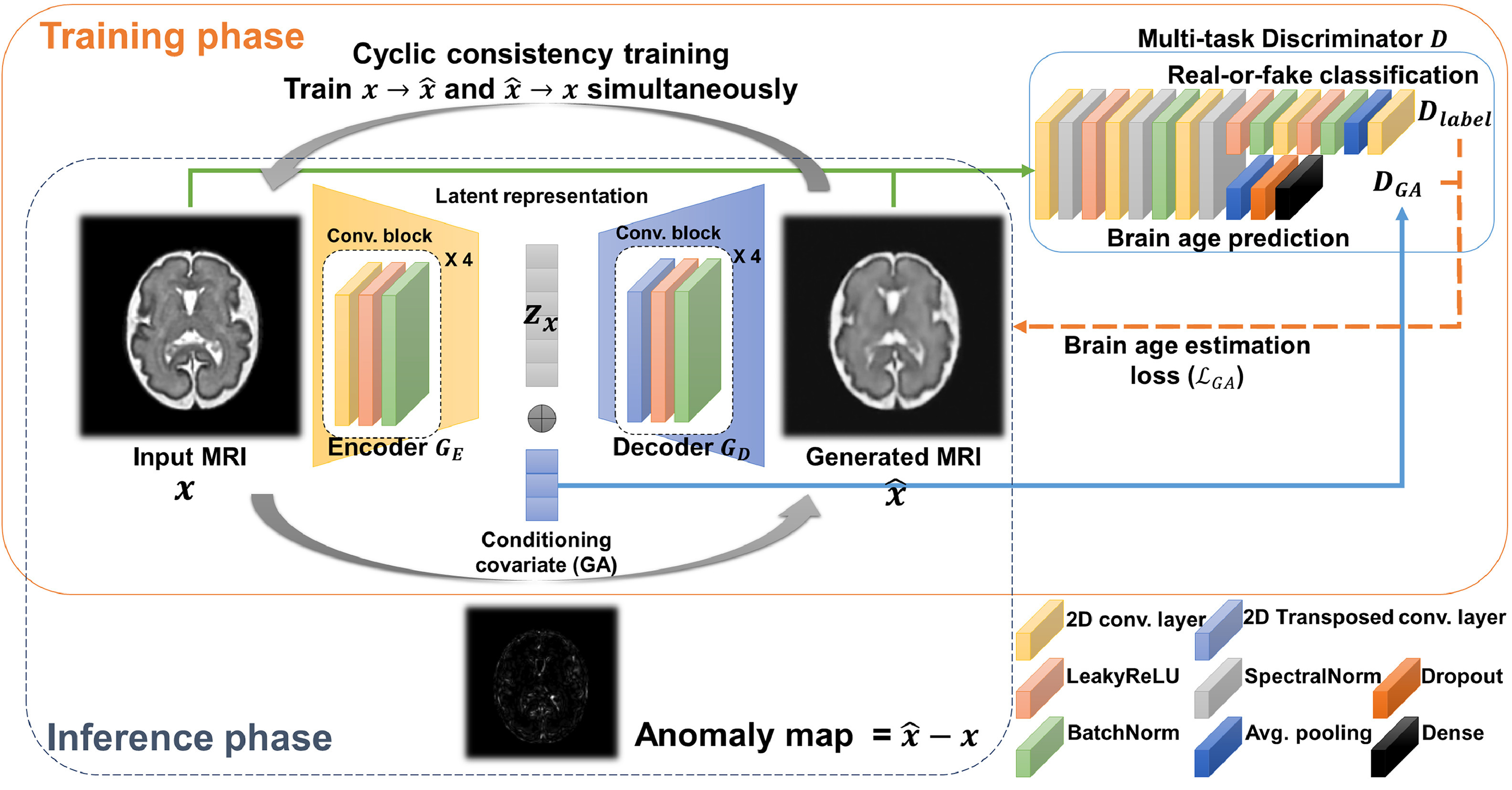 Model architecture for conditional VAE-GAN fetal brain MRI anomaly detection